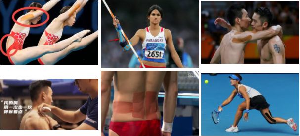 运动员身上贴的五彩胶布是威廉希尔干嘛的？我们能贴吗？