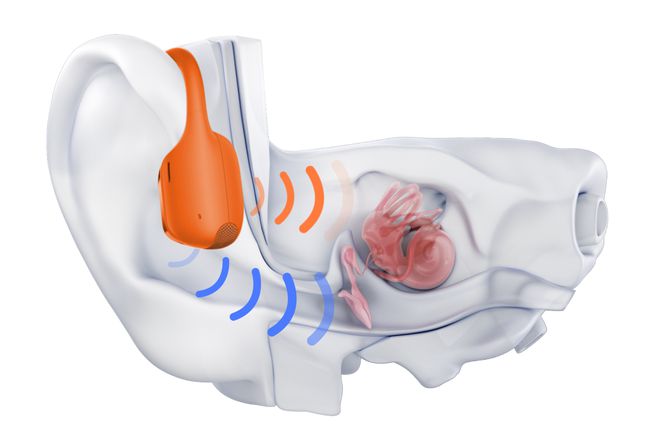 威廉希尔运动耳机音质的“顶流”来了！抢先体验Shokz韶音OpenRunPro2(图4)