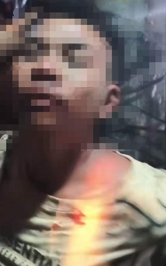 缅北腊戌一偷车贼被民众当场逮到被打得鼻青脸肿！(图2)