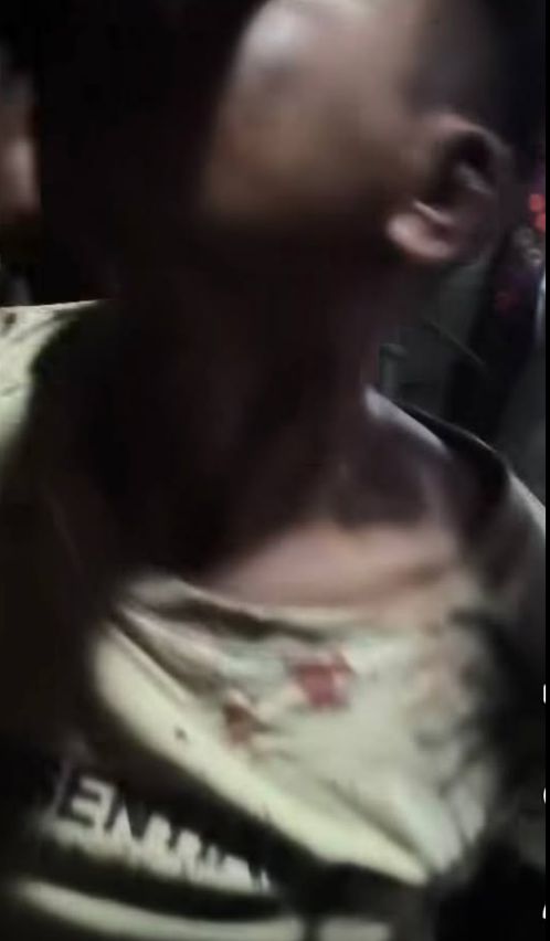 缅北腊戌一偷车贼被民众当场逮到被打得鼻青脸肿！(图1)
