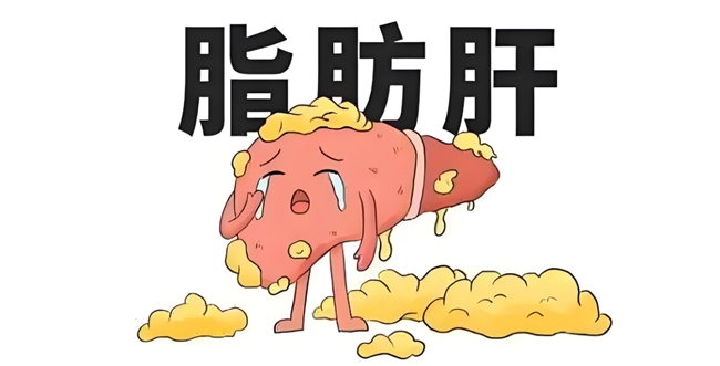 脂肪肝人群必看！迪诺洛克奥利司他胶囊搭配饮食运动get健康逆袭全攻略(图1)