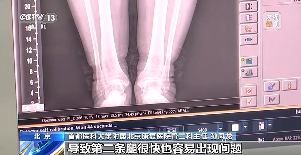 降温了你的骨关节还好吗？这份防护指南请收好(图5)