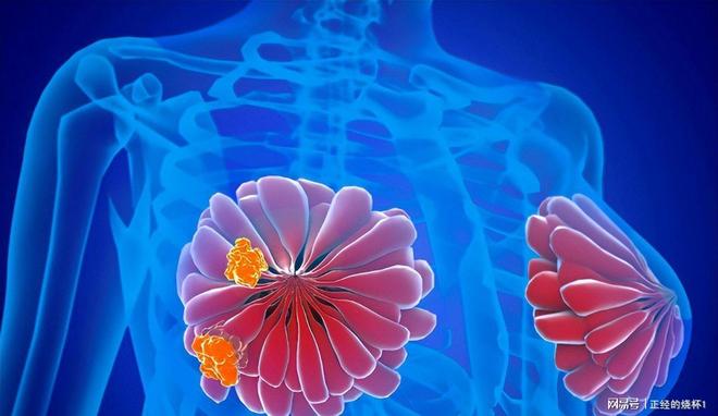 被低估了的“抗癌运威廉希尔WilliamHill动”一次运动就有抗癌效果！不是走路(图4)