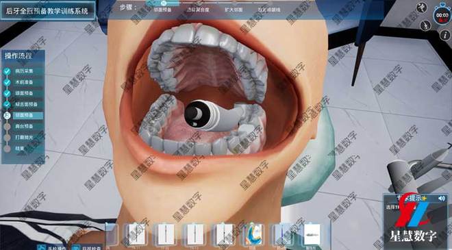 口腔数字化虚拟仿真力反馈设备使用：革新后牙全冠预备技能实训(图3)